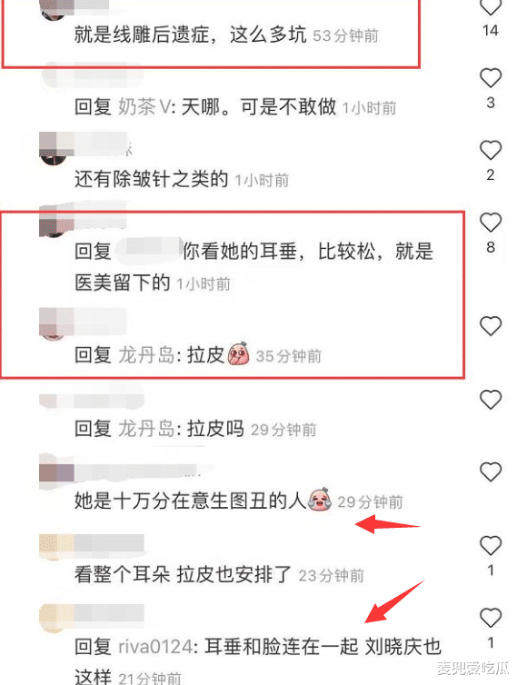 伊能静|53岁伊能静近照曝光？面部苍老脸上怪异，网友质疑是医美后遗症？