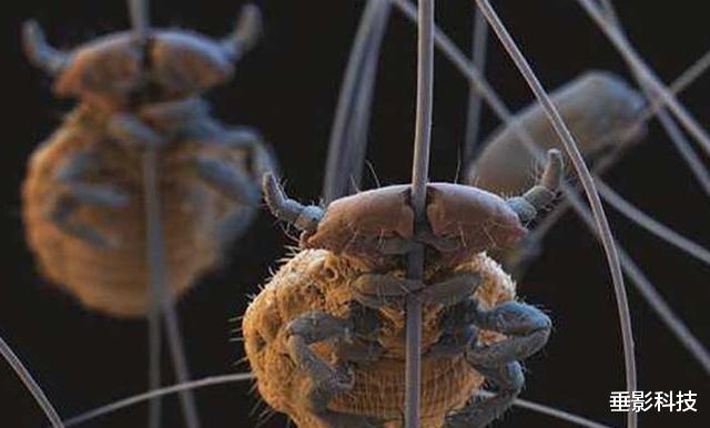  为什么虱子在七八十年代泛滥，现在却很少看到了？