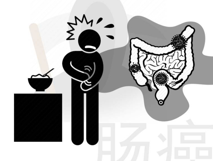 排便|肠道是否癌变？上厕所时瞅一眼就知道答案，3个异常，希望你别占