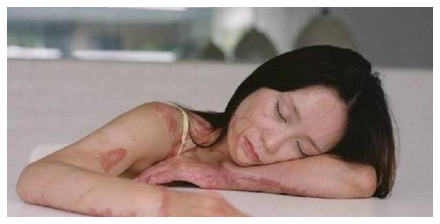 劳荣枝 16岁少女，因拒绝官二代的追求，被毁容，9年过去了，现状如何