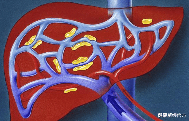 健康新经官方|脚部有4个“异常”，肝或已经“烂如渔网”，一个不占，肝还“强壮”