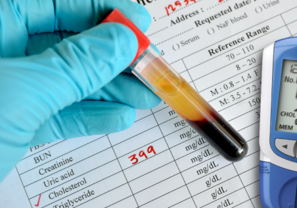 脑梗|男子胆固醇6点8，脑梗离世，医生：吃2种早餐，相当于是在喝油