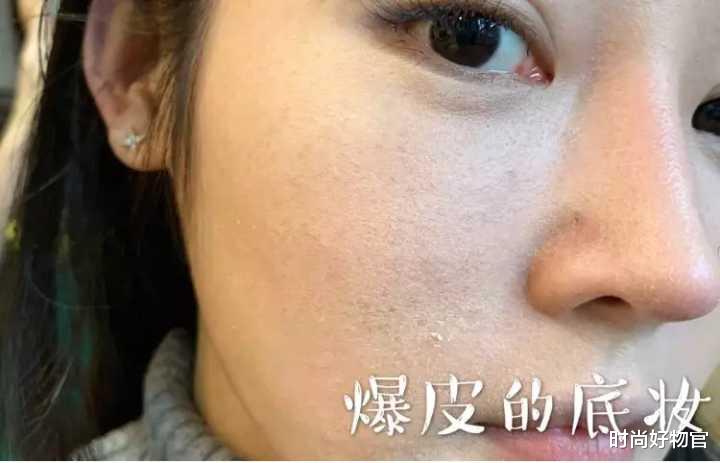 补水 若皮肤出现3个“信号”，证明你的皮肤需要补水了，中1个就得重视