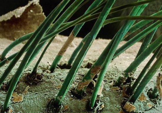 显微镜 电子显微镜下的围观世界, 让人称奇