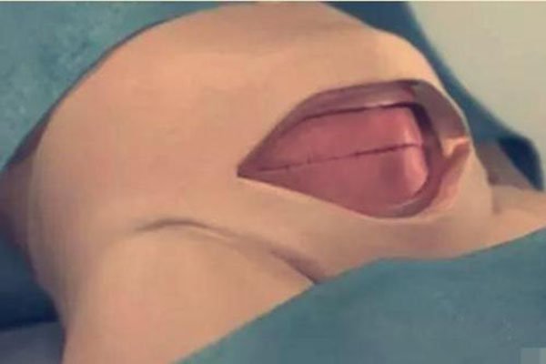 怀孕妈妈知识宝典|八张图详解剖腹产手术全过程 看完真的好心疼女人