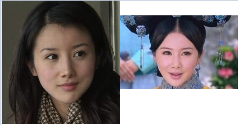 整容|盘点娱乐圈整容失败的女明星，有的整的像僵尸，最后一个可惜了