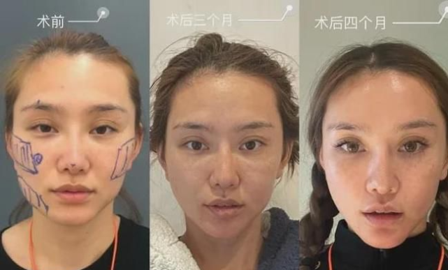 王思聪|王思聪前女友现身迪士尼被骂暴露狂：尊重你的穿衣自由，请你也尊重下小朋友