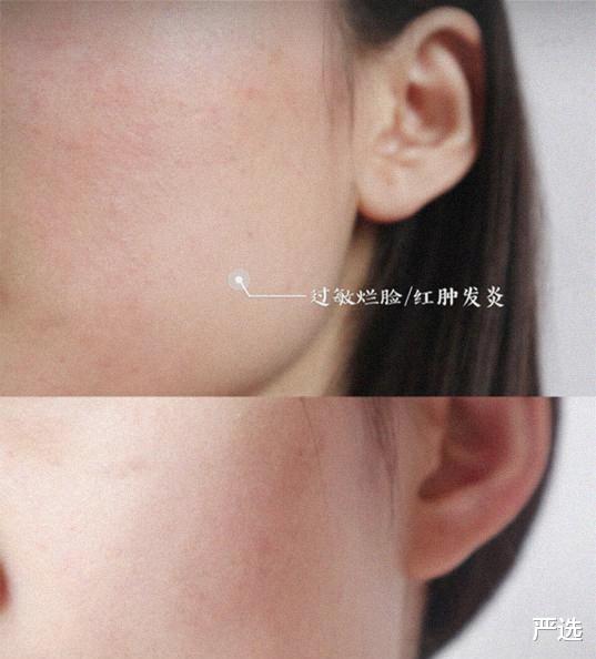 严选|袁咏仪用了5年的面霜，保湿补水抗过敏，张馨予也在用
