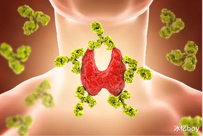 鸡蛋|患上甲状腺结节，建议少碰1种鸡蛋，常补2物甲状腺会感谢你