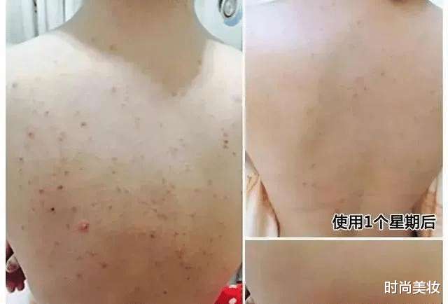 时尚美妆|许晴美了大半辈子,皮肤像牛奶一样嫩滑,透露保养秘诀就两点