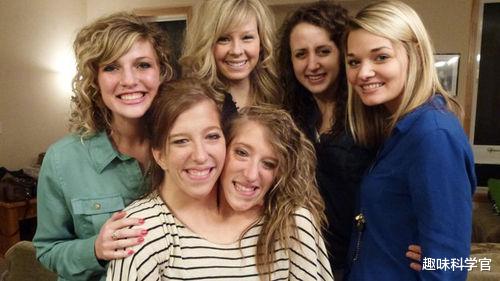 黑洞 “双头连体”姐妹花，如何控制同一个身躯？两个大脑更有优势吗？