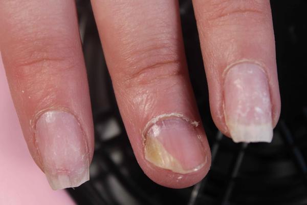 肝脏|手上有3个地方可以看出肝脏好坏，不妨自查一下