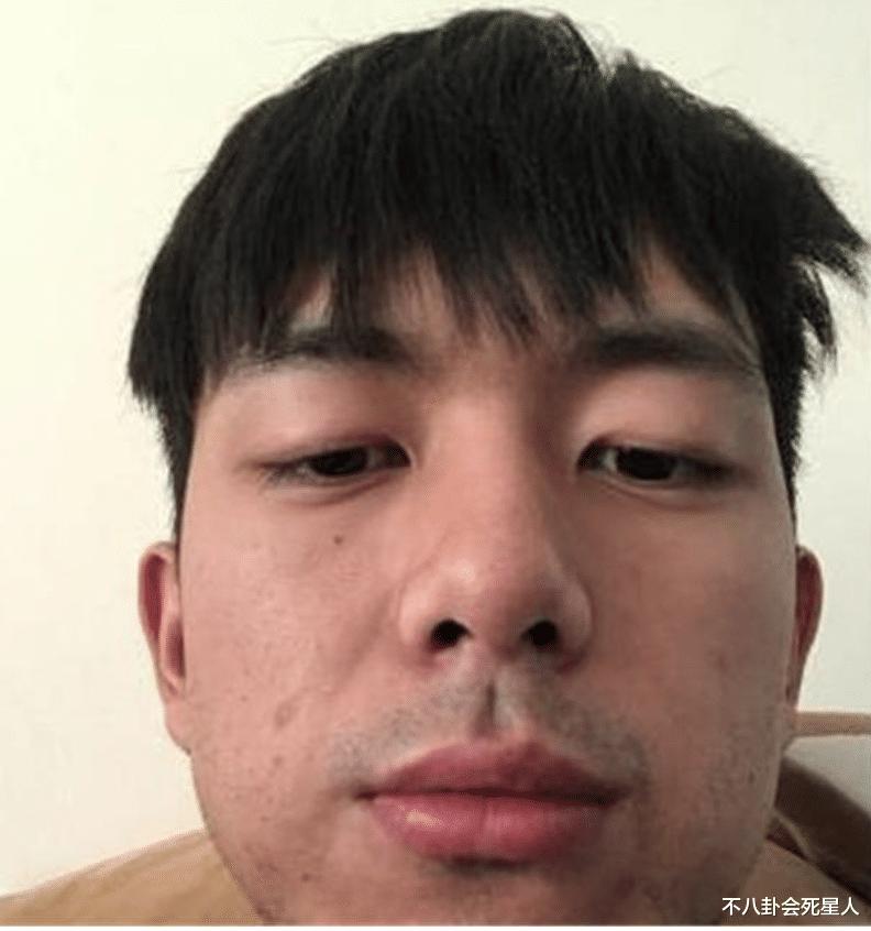 明星素颜|15位当红男星素颜：眯眯眼、月球表面、满脸痘，还暴露动脸痕迹