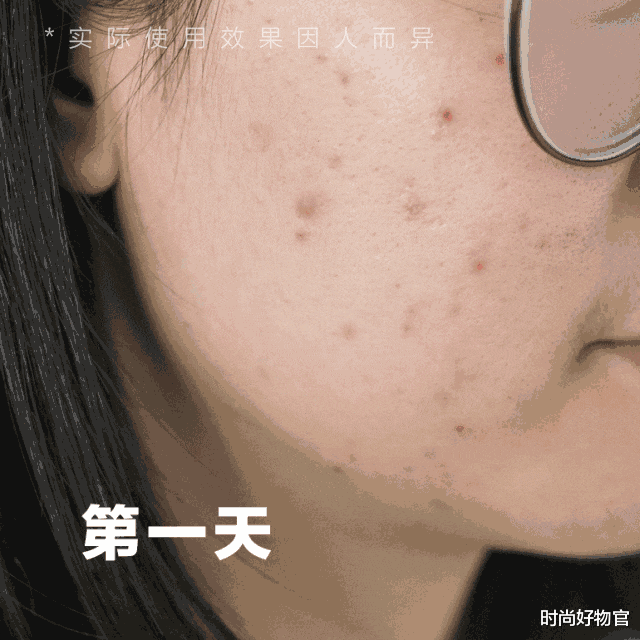 杨幂|杨幂“纯天然”人设崩塌，与美容仪续约，颜值“回春”令人惊艳