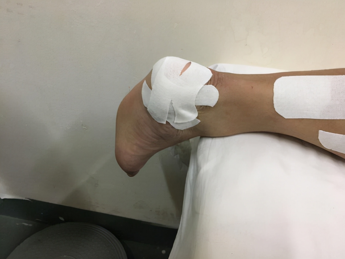 运动|钓鱼到底是不是运动？长时间不科学的钓鱼，这三种慢性病就上门了