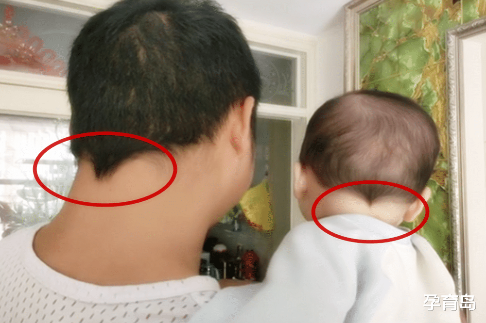 孕育岛|头发会“出卖”一个人的性格?孩子头发“老鼠尾”,暗示性格特征