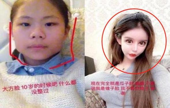 赵又廷|“网红失败整容照”大盘点，前后对比超惨烈，网友：根本没眼看