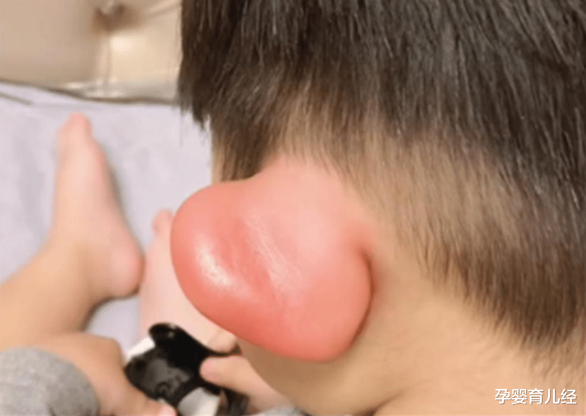 孕婴育儿经|不想孩子被蚊子“恩宠”,试试这些小妙招,别再用风油精了