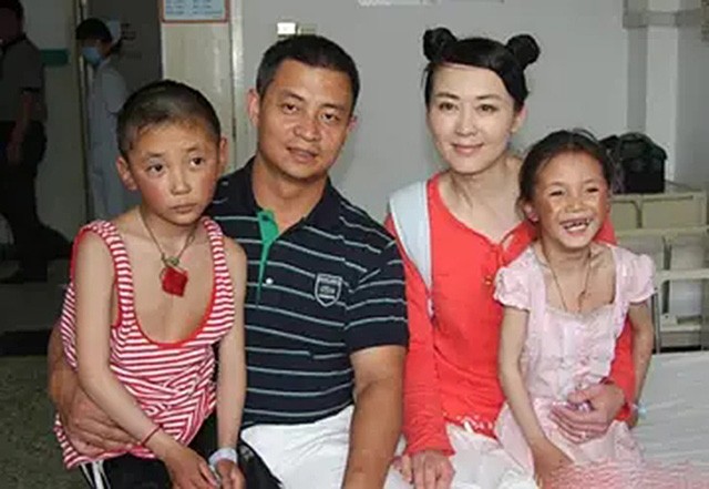 拉齊奧|“雙胞胎冠軍”李大雙李小雙：24歲因身體退役，退役后過得如何？