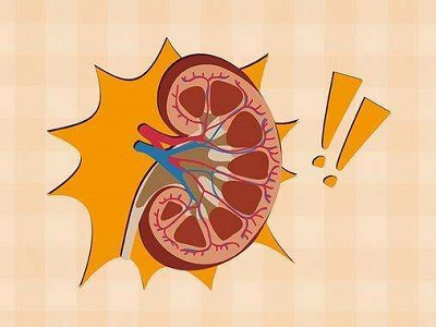 麦吉科普 肾病发生时，身体会出现4个“信号”，请自查
