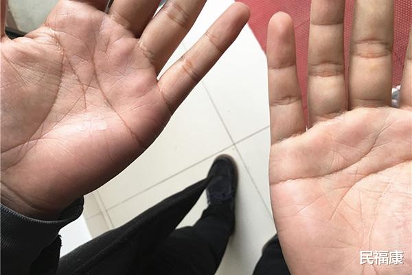 民福康|有些人动不动就爱出汗,有人运动后也不出汗,哪种更健康?