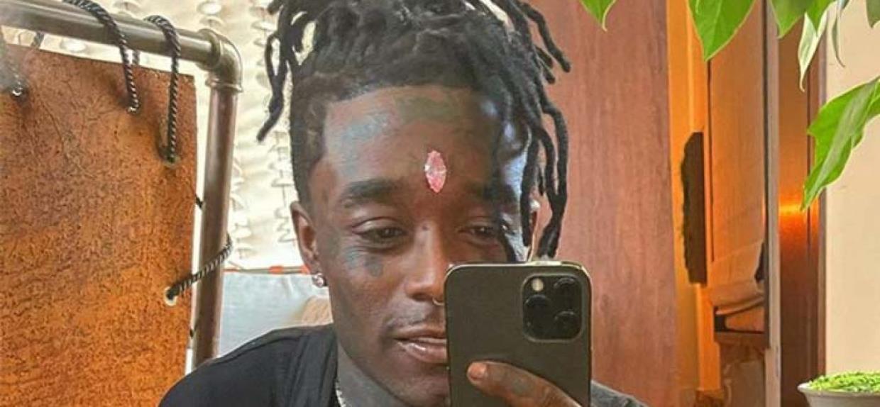 医生|脑门镶钻后，又有歌手钻开头骨植满大金链？网友嘲翻！