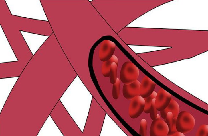 血栓|血管的“刮油机”发现了，不是海带，平尺敞开吃，血栓远离你