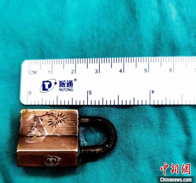 生活报 广州调皮男孩把锁“关”进胃里,医生用时7分钟取出