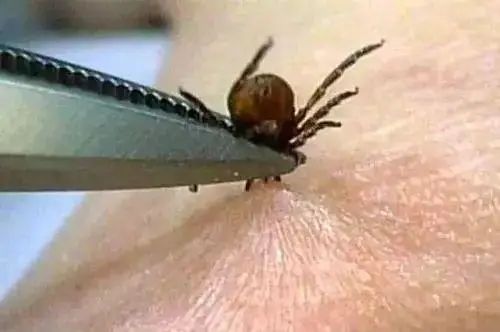 深圳查查吧 这种“夺命小黑点”又开始活动了！深圳人外出千万要注意