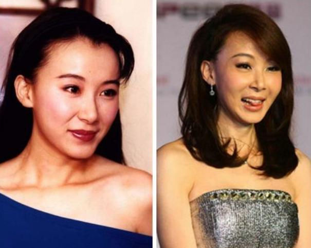 整容|初见惊为天人，再见脸僵如石！这10位女星的脸，到底怎么了