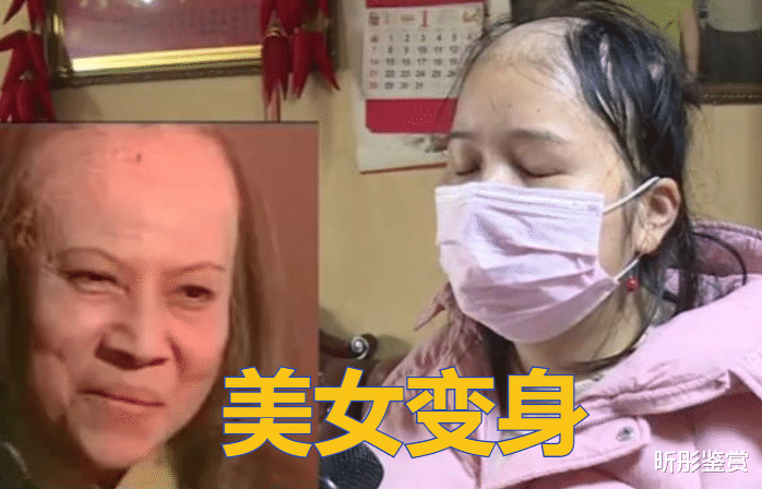 西兰花 美女洗头后秃成“裘千尺”，美发店猖狂回应：我又没给你用硫酸