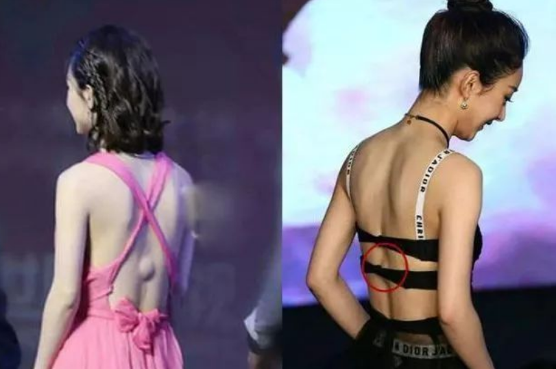 杨幂|因长得太漂亮而走红，拍戏时被男星打成重伤，留下一辈子后遗症！