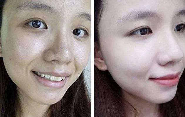 好物官|6年前打美白针成“白灯泡”的女人，现在啥样，网友：还好没跟风
