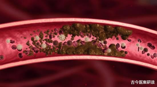 高血脂|“血管清洁工”已出现,经常吃点,清理血管垃圾,血液清如水