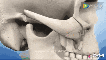 后遗症|做了颧骨内推的明星真的变美了吗?推平容易后悔难,后遗症一大堆