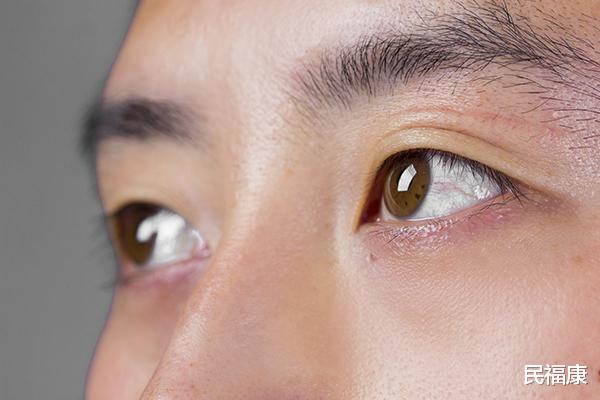 衰老|男性开始衰老身体会出现哪些变化？对照一下，希望你一个也不占