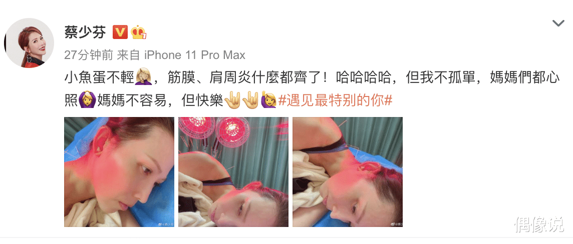 蔡少芬|三胎妈妈蔡少芬晒病床针灸照，画面揪心，感慨：当妈妈不容易