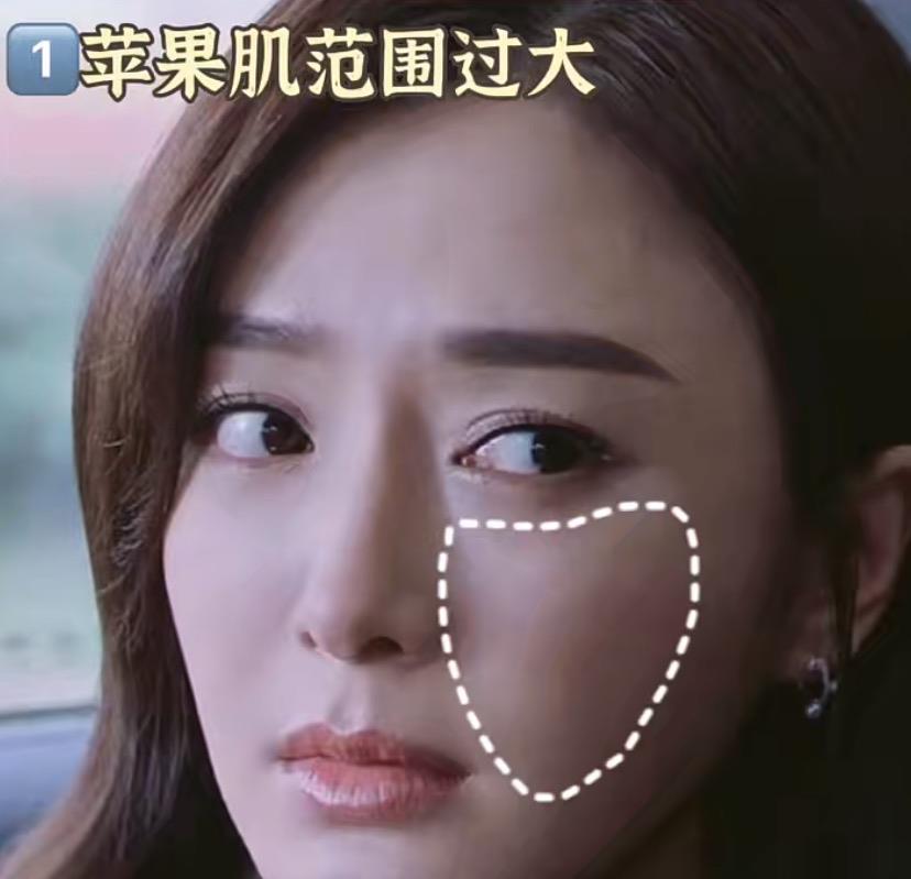 秦岚|秦岚的脸有点失真了？为什么上了年纪的女演员都喜欢强求少女感？