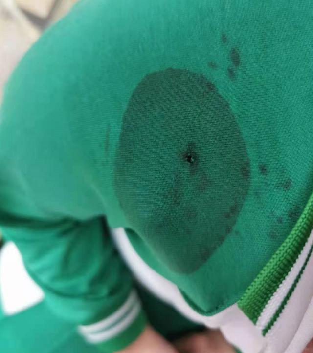 太平洋亲子网 9岁男孩被老师揪头发致皮骨分离，穿刺7次！但更令人后怕的是...