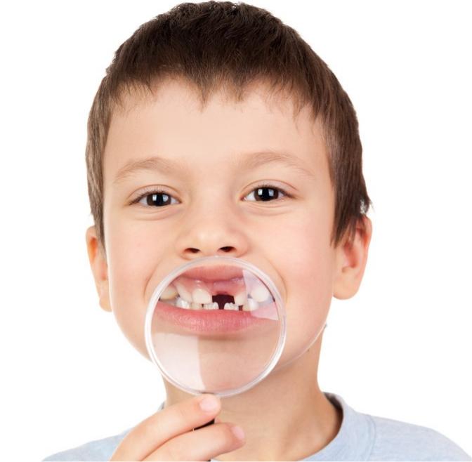 在廊坊，缺牙时间太久还可以做种植牙吗