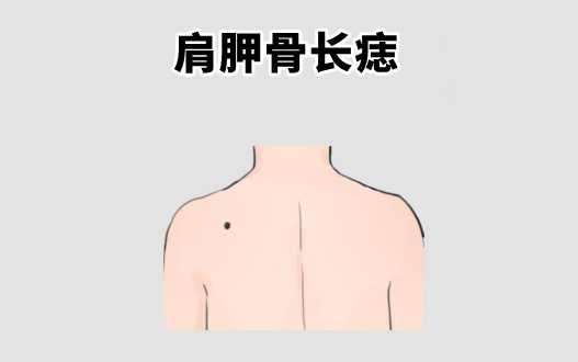 中国易经风水 “百里难挑的5颗痣”，个个不差钱，前半生富，后半生福！