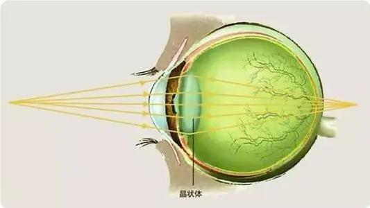 近视|【科视眼科】不能轻视的远视