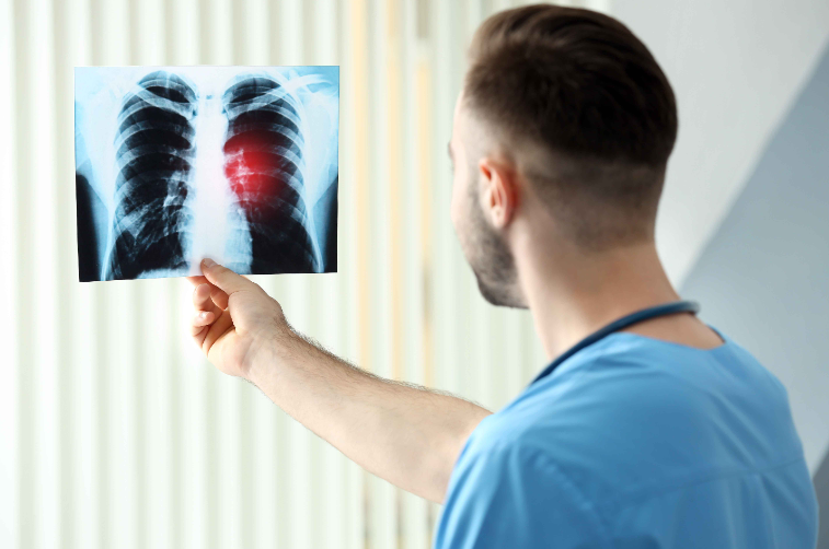 冠心病|3种食物虽美味，却会刺激肺结节生长，医生：再喜欢也要管住嘴