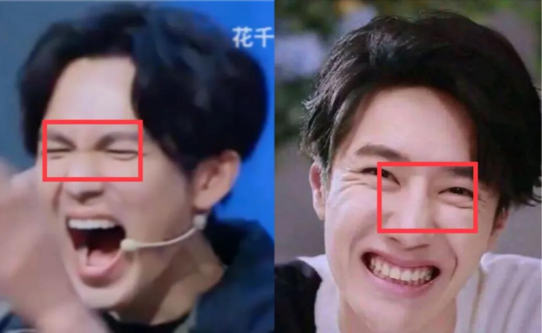 整容|内娱“假鼻子”大PK，谁的假到逆天，谁的越整越残？