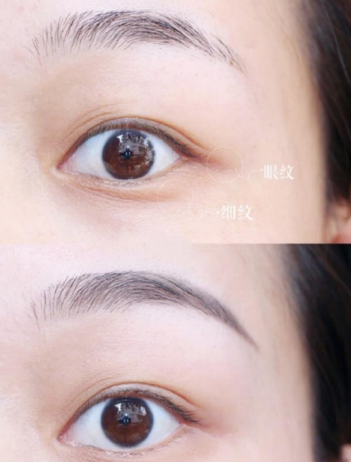 好物官|妻子为讨丈夫欢心带妆睡觉,6年后“烂脸”遭嫌弃,丈夫:离婚吧