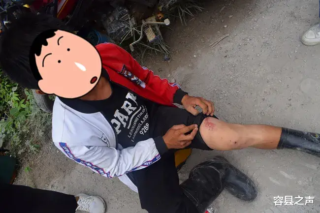 驾驶 广西乡间小道两车相撞 幸有头盔救了命