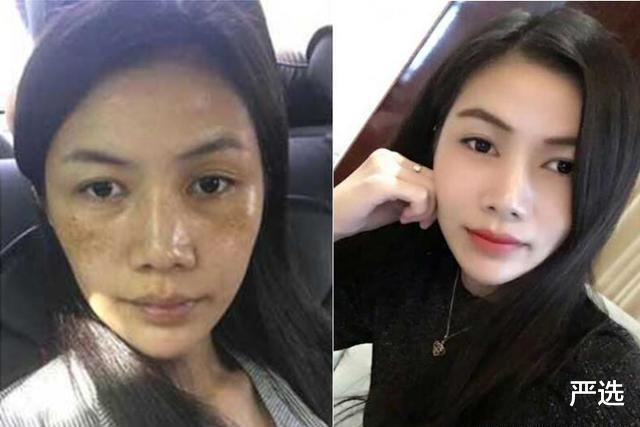 |脸上长“色斑”不必慌，药店这款平价“精华液”，美白淡斑还嫩肤
