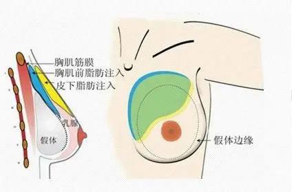 小美说美|女生怎么能让胸快速变大