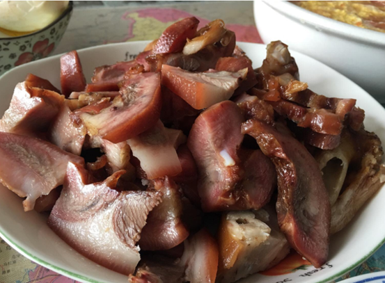 脑梗|40岁男子突发脑梗离世，医生叹息：1食物吃一次等于喝“一桶油”