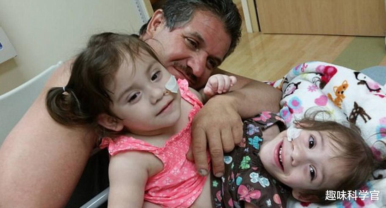 黑洞 “双头连体”姐妹花，如何控制同一个身躯？两个大脑更有优势吗？